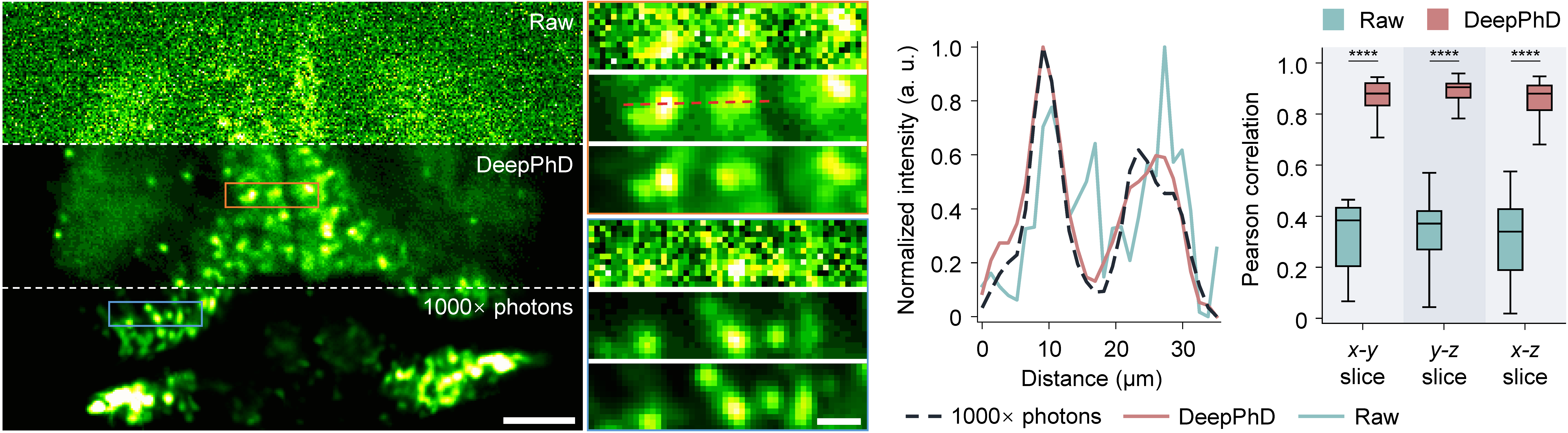 Morphology comparison of Raw, DeepPhD, and high-SNR reference with correlation analysis