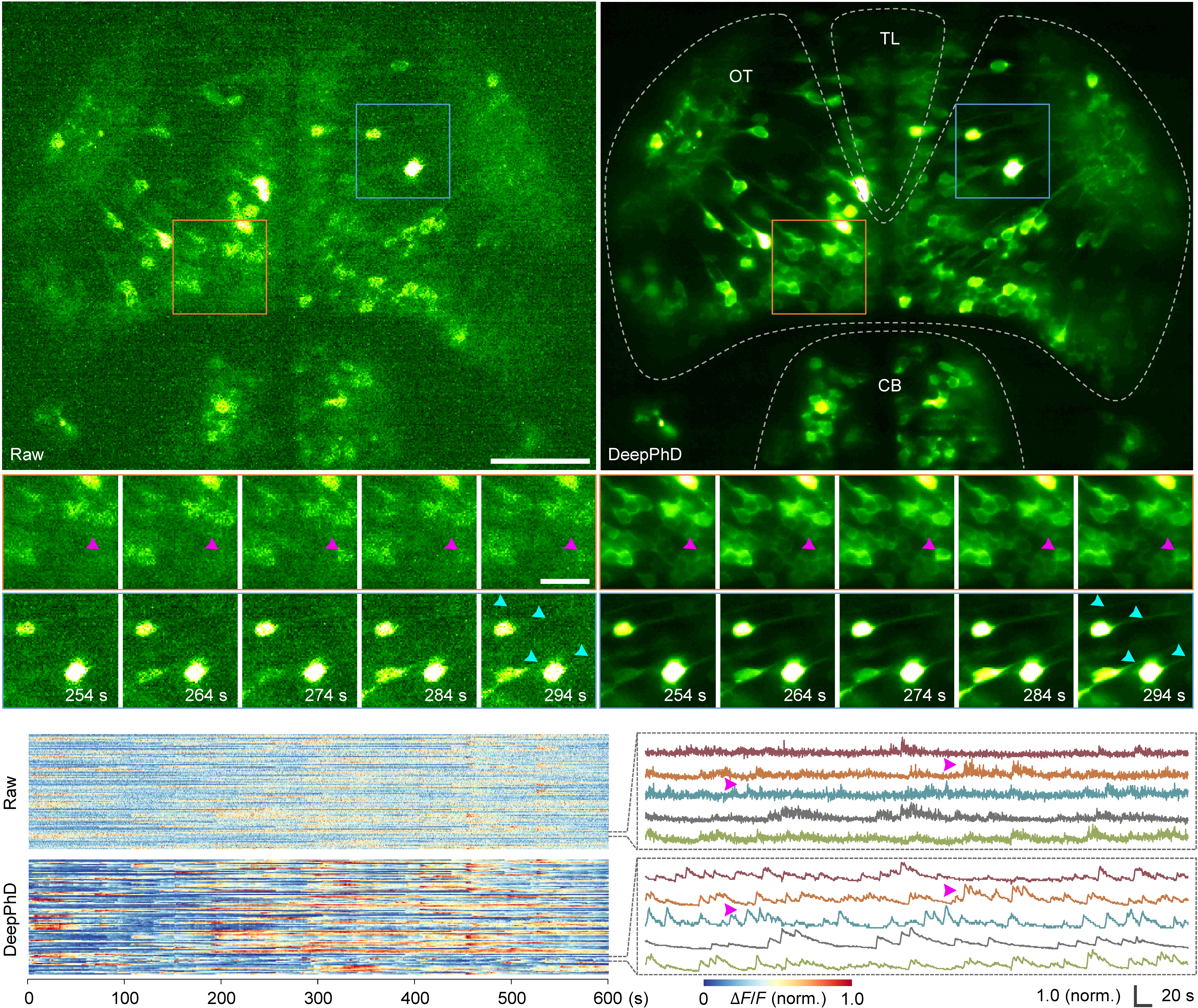 Calcium imaging traces of GABAergic neurons before and after DeepPhD