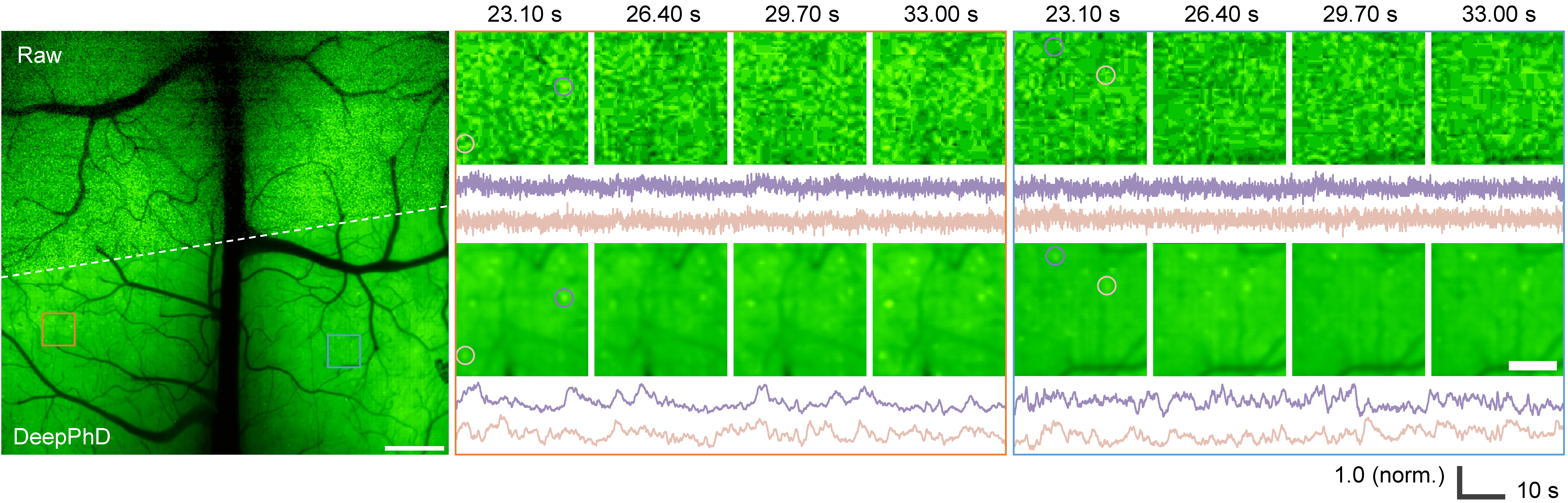 Raw versus DeepPhD neural activity and fluorescence traces in freely behaving mice