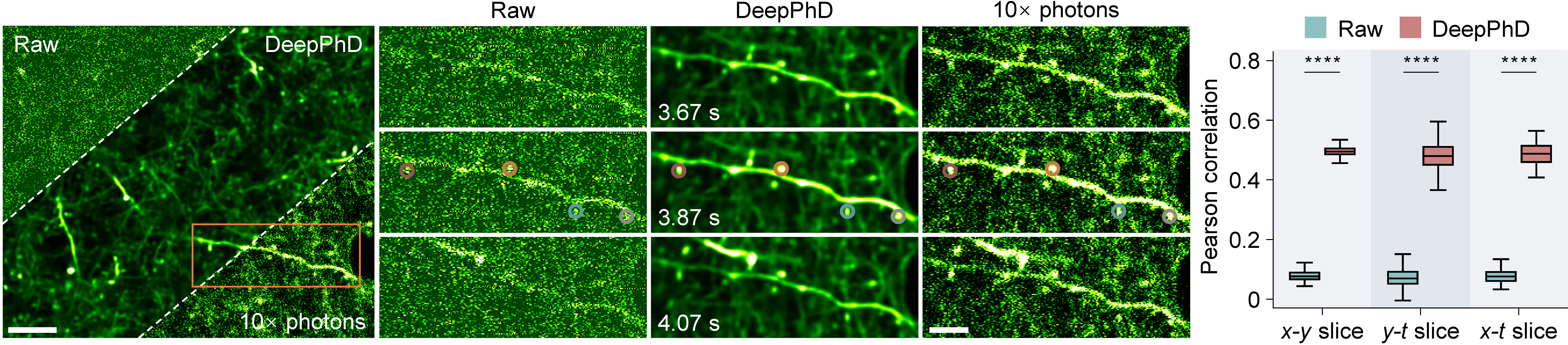 Dendritic spine restoration and calcium dynamics with DeepPhD