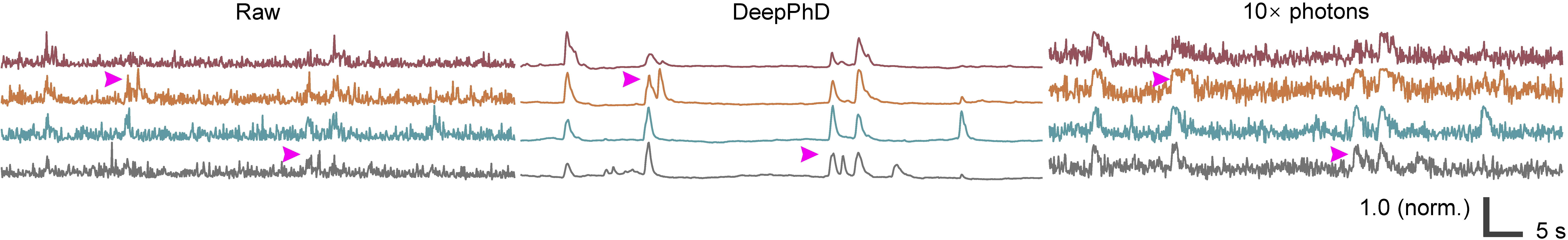 Calcium traces showing functional heterogeneity of dendritic spines