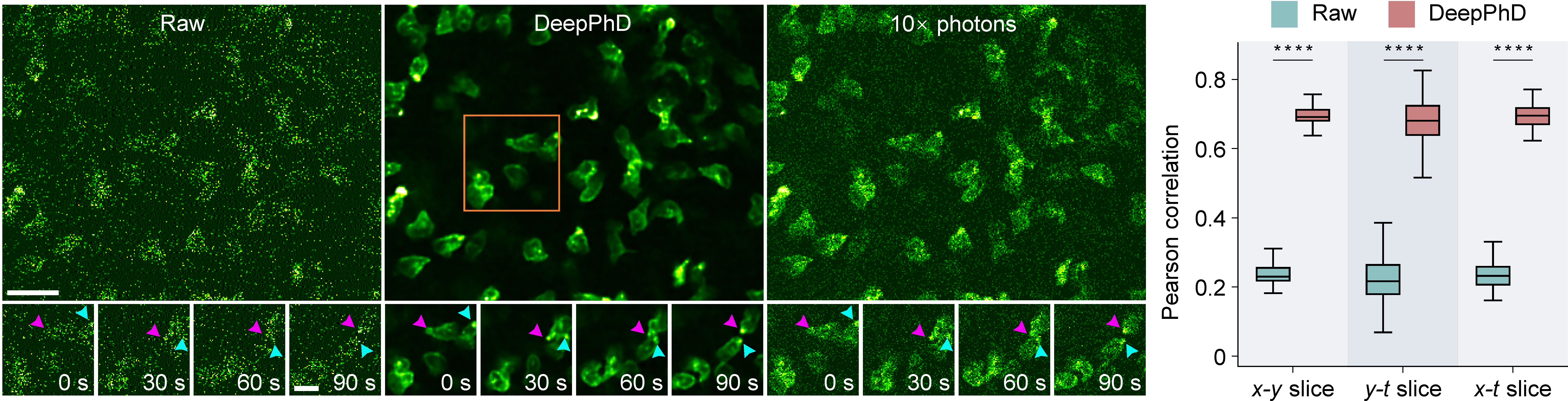Neutrophil morphology and migration dynamics restored by DeepPhD