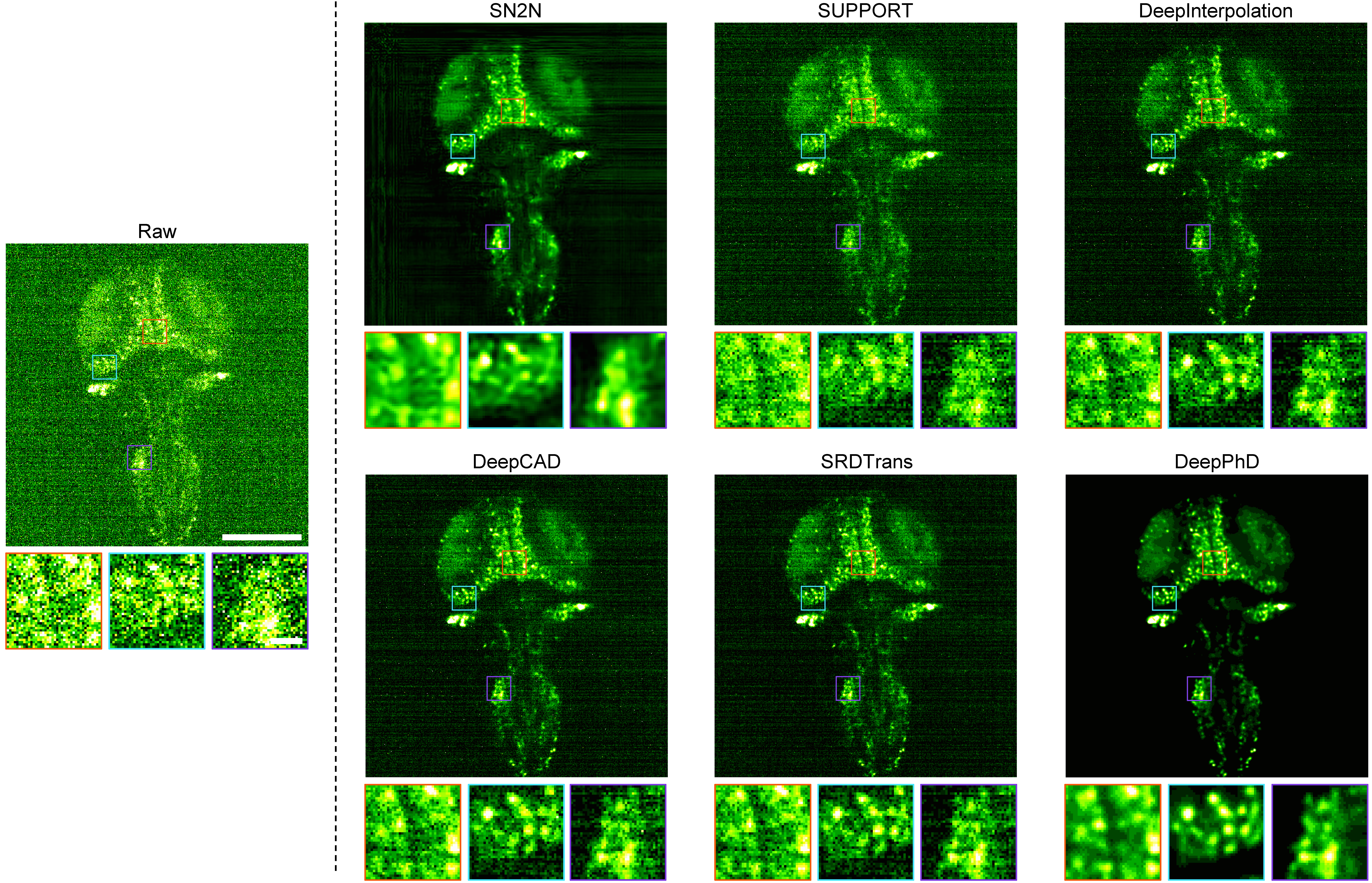 Comparing different denoising methods on light-sheet imaging of larval zebrafish